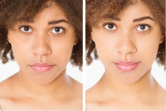 ME Line behandeling in Osdorp